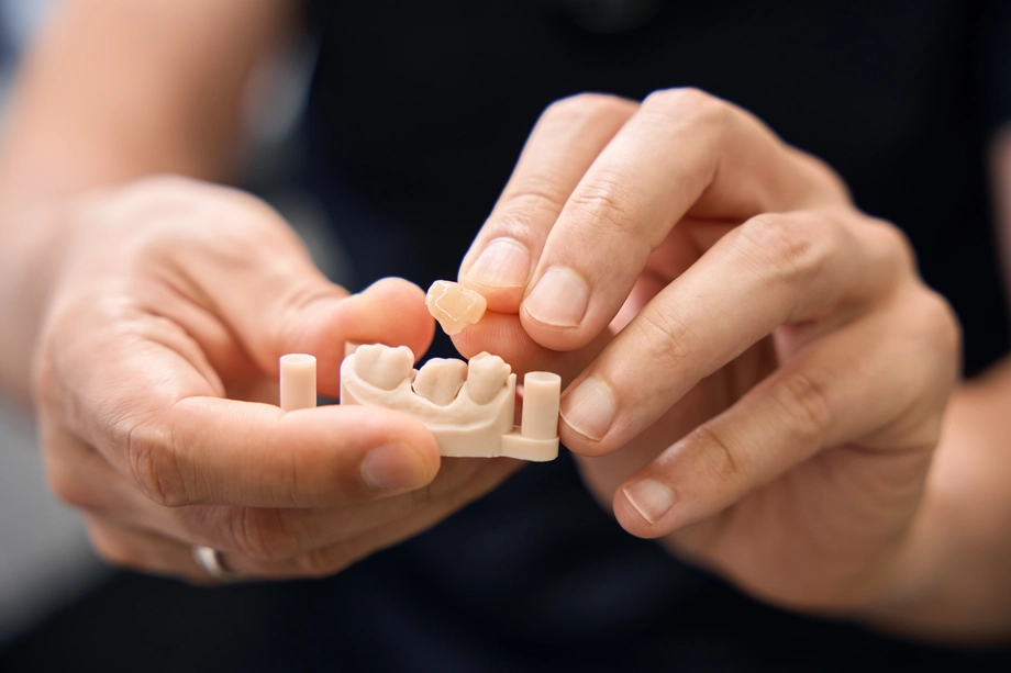 dental crowns